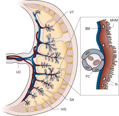 • Fig. 8.1, The placental barrier. This primarily consists of the syncytiotrophoblast and the fetal capillary (FC) endothelium. Of these structures, it is primarily the two polarised plasma membranes, the microvillous (MVM) and the basal plasma membrane (BM) of the syncytiotrophoblast, that restrict the transfer of molecules like glucose and amino acids. IVS, intervillous space; N, nucleus of syncytiotrophoblast; SA, spiral artery; UC; umbilical cord; VT, villous tree.