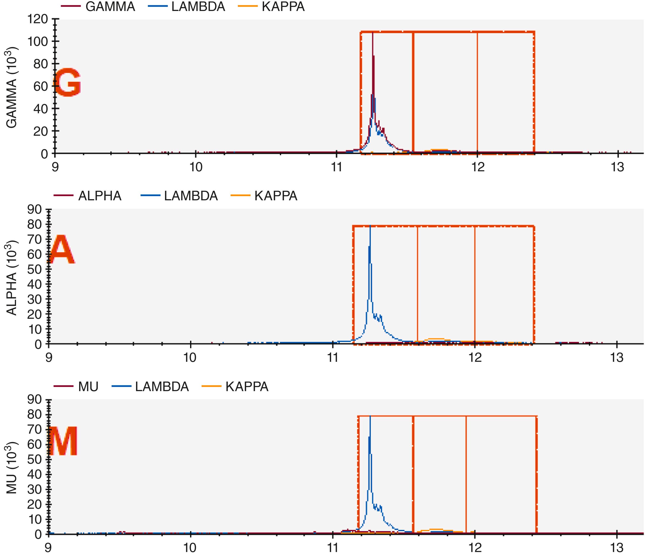 E-FIGURE 173-2, Mass spectrometry to identify monoclonal protein.