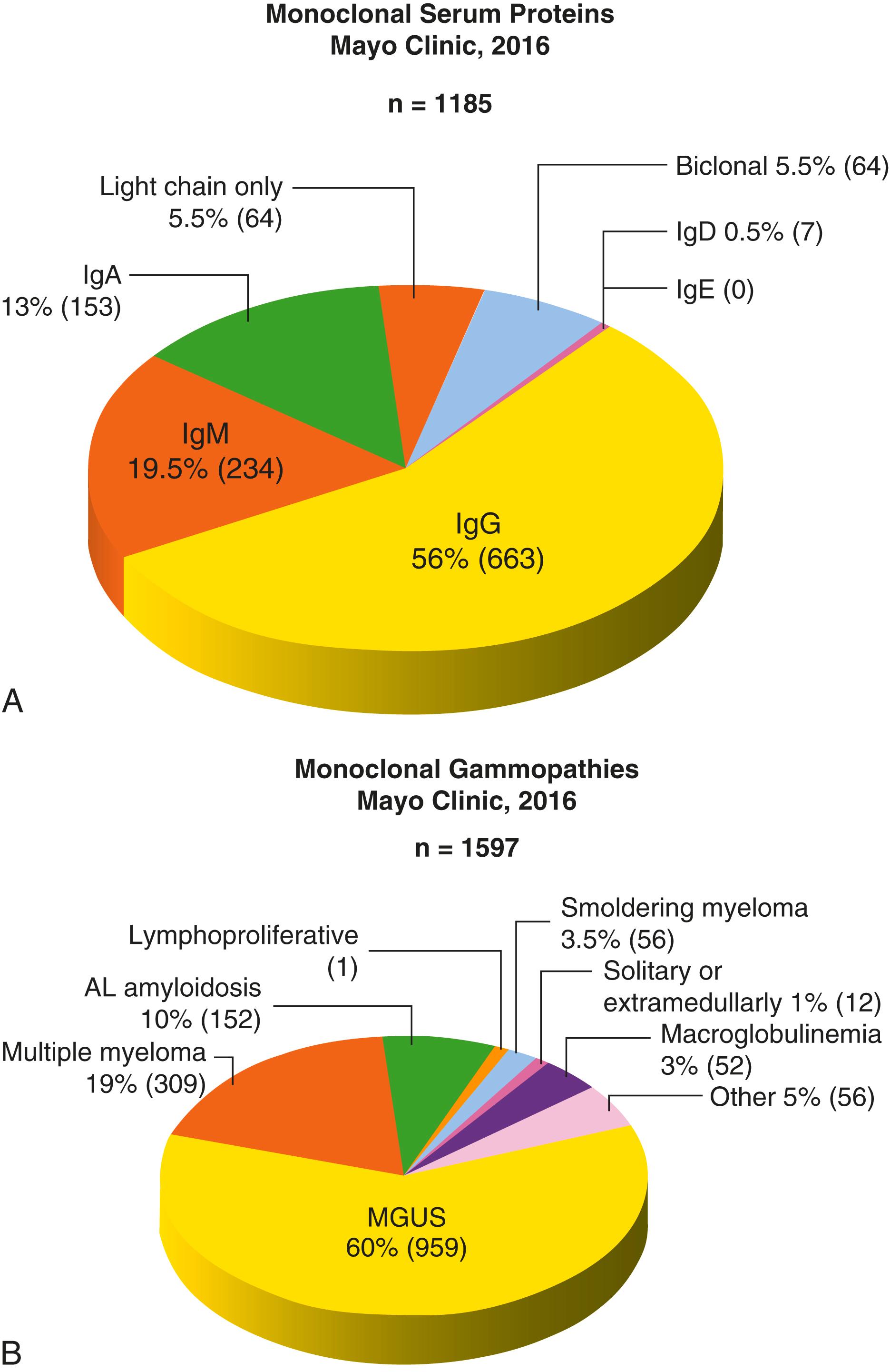 E-FIGURE 173-3, Monoclonal gammopathy.