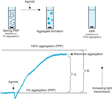 Figure 140.1, Light-transmission aggregometry.