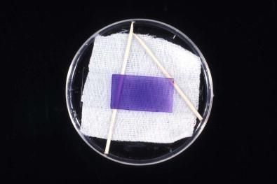 Figure 19-4, A toluidine blue-stained wet film being kept for later examination in a Petri dish containing moistened gauze.
