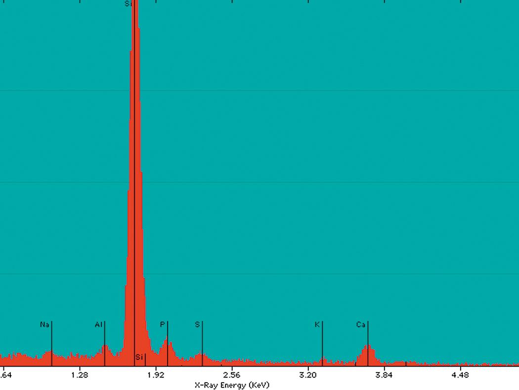 Figure 10.14, Silicosis. Energy-dispersive x-ray analysis spectrum shows a peak for silicon (Si) ( Na = sodium, Al = aluminum, P = phosphorous, S = sulfur, K = potassium, Ca = calcium).