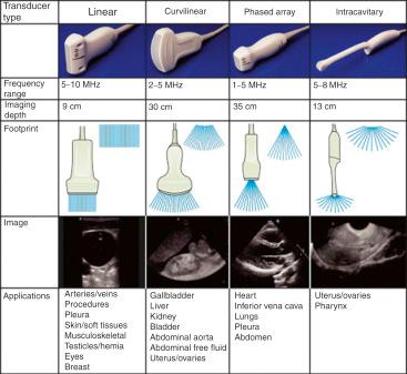 Fig. 32.1, Basic ultrasound transducer types and their characteristics.