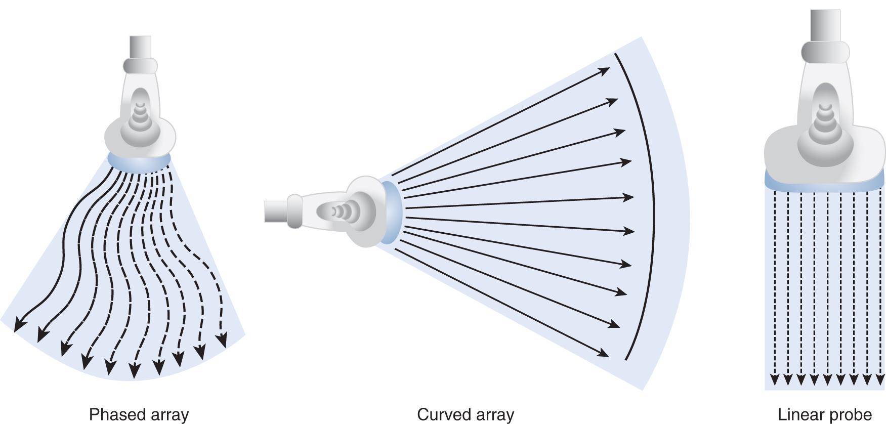 Fig. 30.1, Ultrasound Probe Types.