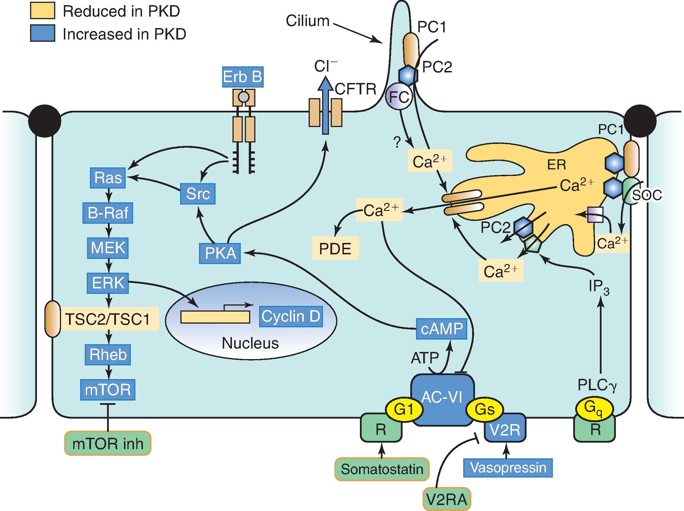 Fig. 39.1, Renal tubular epithelial cell showing location and interactions of polycystin 1 and polycystin 2. (Top) The luminal surface with a single cilium. (Both sides and bottom) The basolateral surfaces. Mutations in PC1 (gold ovals) or PC2 (blue hexagons) result in changes in the intracellular calcium level or increases in the level of cAMP. A change in the balance of these two critical intracellular components leads to alterations in the Ras pathway, the mTOR pathway, cell turnover, apoptosis, and fluid secretion through the CFTR channel. Mutations in PC1 and PC2 colocalize to the primary cilium and the basolateral membranes. PC2 resides alone in the ER. G-coupled receptor activation increases the concentration of cAMP. Interference with G-coupled receptor processes can return the increased cAMP level seen in ADPKD to normal. Blockade of the vasopressin 2 (V 2 ) receptor by a V 2 receptor antagonist is one example. PC1 interacts with the tuberous sclerosis complex proteins (TSC2 and TSC1) regulating the mTOR pathway. Therapies aimed at reducing G-coupled receptor, EGF receptor, CFTR channel, mTOR, and cyclin activity or increasing ER release of calcium may normalize epithelial cell function in ADPKD. AC-VI, Adenylate cyclase; ADPKD, autosomal dominant polycystic kidney disease; B-Raf, proto-oncogene serine/threonine-protein kinase; cAMP, cyclic adenosine monophosphate; CFTR, cystic fibrosis transmembrane conductance regulator; EGF, epithelial growth factor; ER, endoplasmic reticulum; Erb, epidermal growth factor (erythroblastic leukemia, viral); ERK, extracellular signal-regulated kinase; Inh, inhibitor; IP 3 , inositol triphosphate; MEK, mitogen signal-regulated kinase; mTOR, mammalian target of rapamycin; PC1, polycystin 1; PC2, polycystin 2; PDE, phosphodiesterase; PKA, phosphokinase A; PKD, polycystic kidney disease; R, receptor; Ras, renin-angiotensin system; Rheb, Ras homolog enriched in brain; SOC, store-operated channels; Src, nonreceptor (cytoplasmic) protein tyrosine kinase; V2R, vasopressin V 2 receptor; V2RA, vasopressin V 2 receptor antagonist.