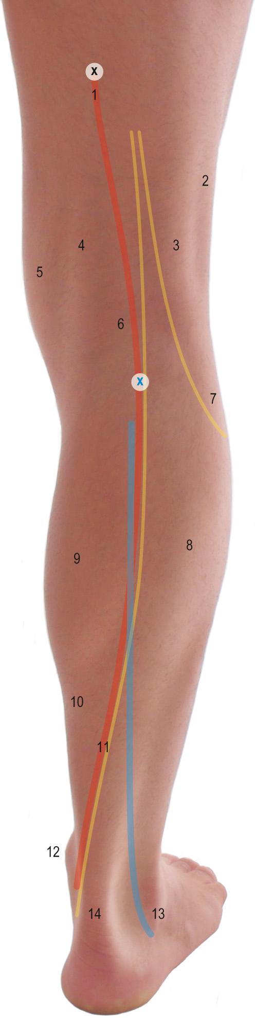 Fig. 82.1, The posterior aspect of the knee and leg. Key: 1, popliteal artery: passing from a point (black X) 2.5 cm medial to the posterior midline of the thigh at the junction of its middle and lower thirds to a point halfway between the femoral condyles/the midaxial line of the calf (blue X); 2, iliotibial tract; 3, tendon of biceps femoris and common fibular nerve located medially; 4, semimembranosus and semitendinosus; 5, gracilis; 6, popliteal fossa; 7, head of fibula; 8, gastrocnemius, lateral head; 9, gastrocnemius, medial head; 10, soleus; 11, posterior tibial artery and tibial nerve, which run from the midline of the calf at the neck of the fibula level to a point one-third of the way from the posterior border of the medial malleolus to the calcaneal tendon; 12, medial malleolus; 13, lateral malleolus and short saphenous vein passing posteriorly; 14, calcaneal tendon insertion on to calcaneus.