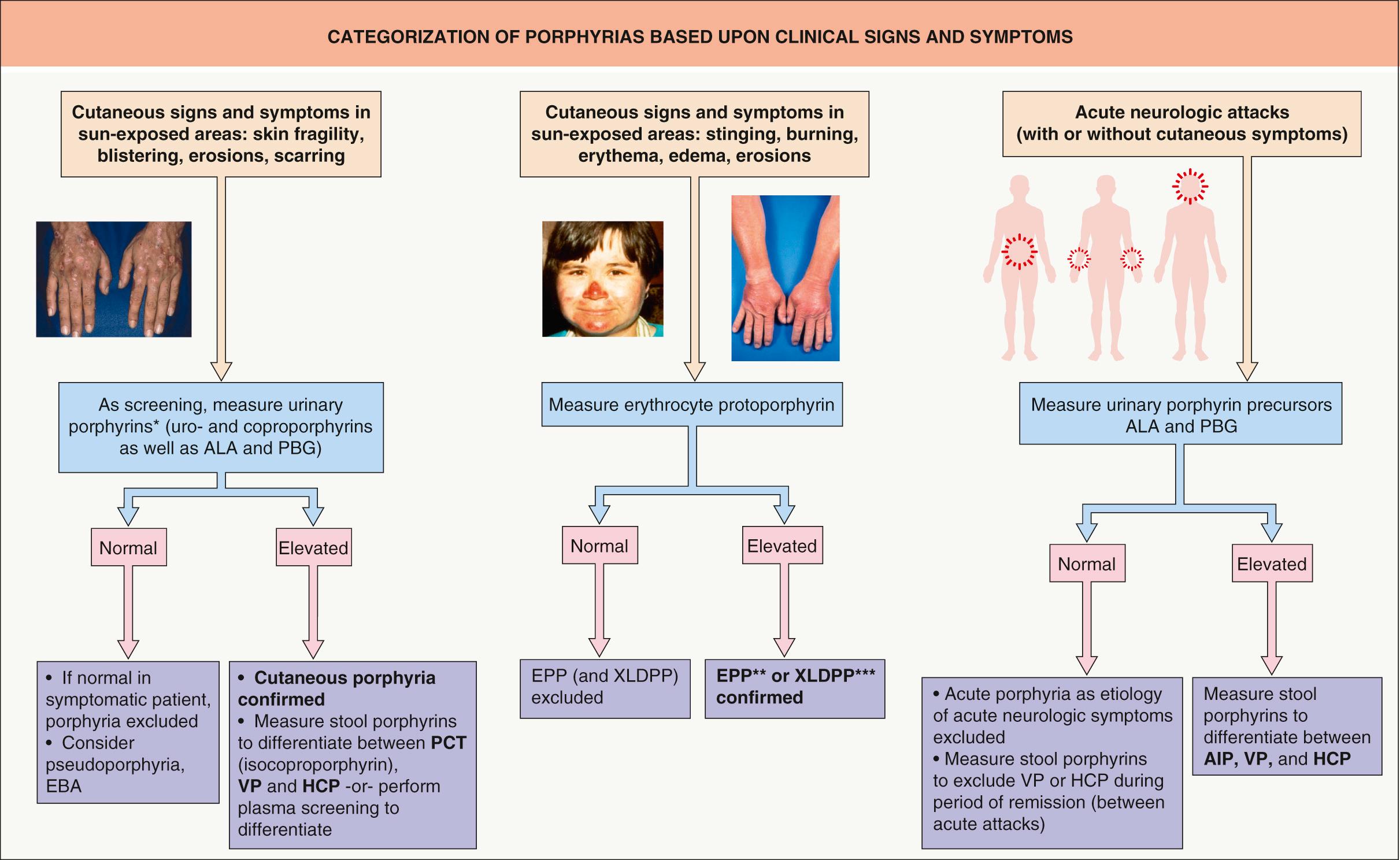 Fig. 49.2, Categorization of porphyrias based upon clinical signs and symptoms.