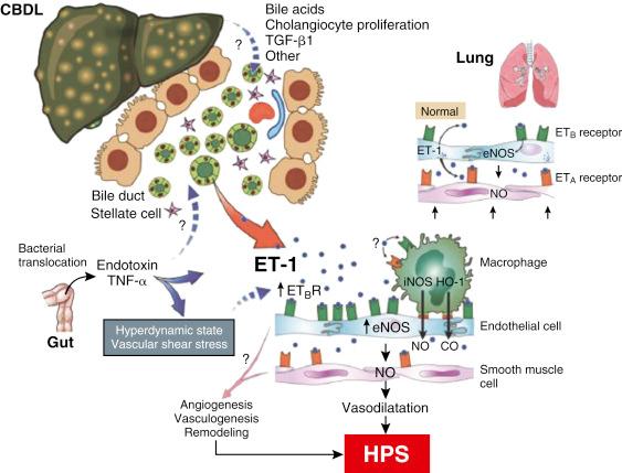 FIGURE 39-4, Proposed mechanisms of hepatopulmonary syndrome. CBDL , Common bile duct ligation; CO , carbon monoxide; eNOS , endothelial nitric oxide synthase; ET-1 , endothelin-1; ET A , endothelin A; ET B , endothelin B; ET B R , endothelin B receptor; HO-1 , heme oxygenase-1; iNOS , inducible nitric oxide synthetase; NO , nitric oxide; TGF-β1, transforming growth factor-β1; TNF-α , tumor necrosis factor-α.