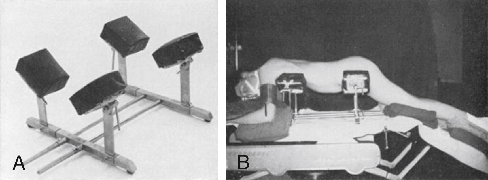 Figure 25.2, Relton-Hall frame.