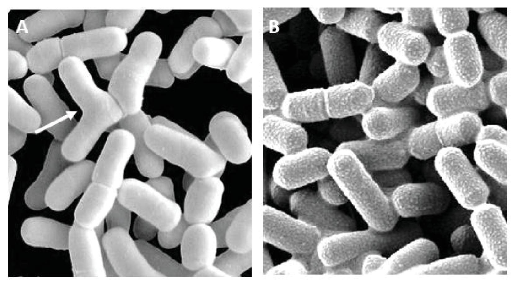 Fig. 18.1, Electron Microscopic Images .