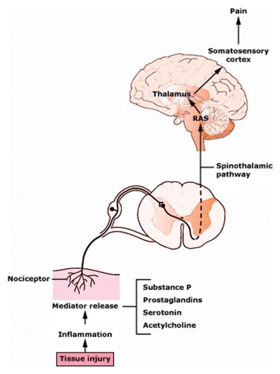 Fig. 1.8.1, Various analgesic drugs can reduce pain sensation by targeting the afferent pain pathway that is activated by inflammation caused by acute surgical tissue injury (e.g., incision, dissection, burns) and/or direct nerve injury (e.g., nerve stretching, compression, transection).