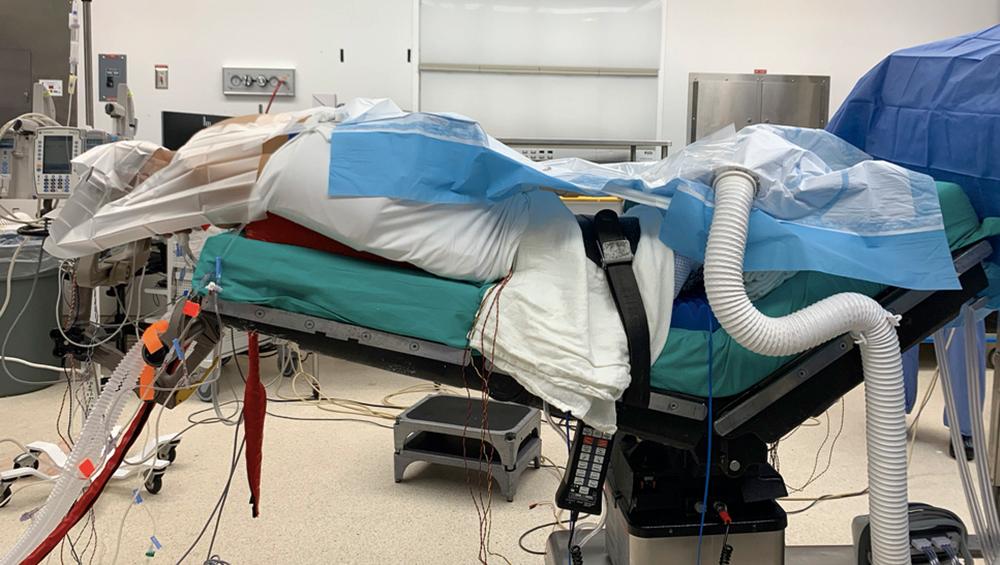 Fig. 105.1, Operative positioning on a standard table with a Mayfield head holder. Note the patient is in slight reverse Trendelenburg with the knees bent.