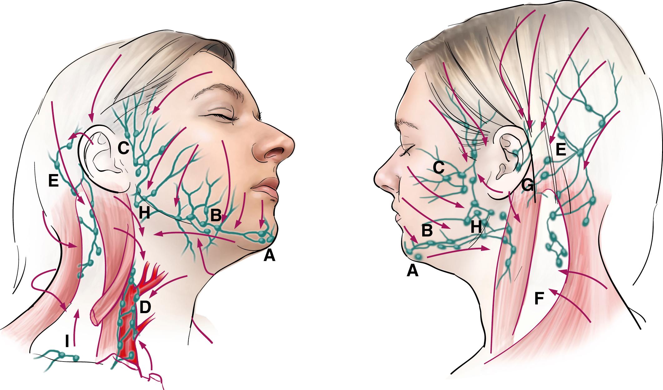 Fig. 71.1, Nodal drainage patterns of the head and neck. A, submental. B, submandibular. C, pre-auricular. D, deep cervical/jugular chain. E, occipital. F, posterior cervical chain. G, posterior auricular. H, parotid. I, supraclavicular.