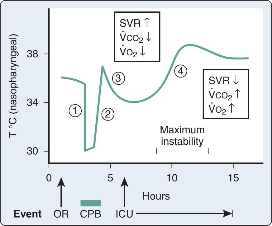 Fig. 30.2, Nasopharyngeal temperature during and after cardiac surgical procedures. (1) Core (ie, blood) cooling on cardiopulmonary bypass (CPB). (2) Core warming on CPB. (3) Afterdrop in temperature (T) after separation from CPB. (4) Rewarming after admission to the intensive care unit (ICU). Systemic vascular resistance (SVR) is increased, and carbon dioxide production (V̇CO 2 ) and oxygen consumption (V̇O 2 ) are decreased on admission to the ICU because of residual hypothermia. During rapid rewarming, SVR decreases and V̇CO 2 and V̇O 2 increase; these changes can cause marked cardiac and ventilatory instability. OR, Operating room.