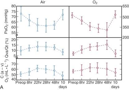 Figure 5-9, A, Arterial oxygen tension (Pa o 2 ) , venous admixture ( ) , and arteriovenous oxygen content difference [C(a − v)O 2 ] measured preoperatively and at intervals early postoperatively in 10 adults undergoing operation with cardiopulmonary bypass. B, Pre- and postoperative values for minute ventilation ( ) , frequency (f), and tidal volume (V t ) in the same patients. Air- and O 2 -breathing results have been combined, and mean values for the group at each time are shown.