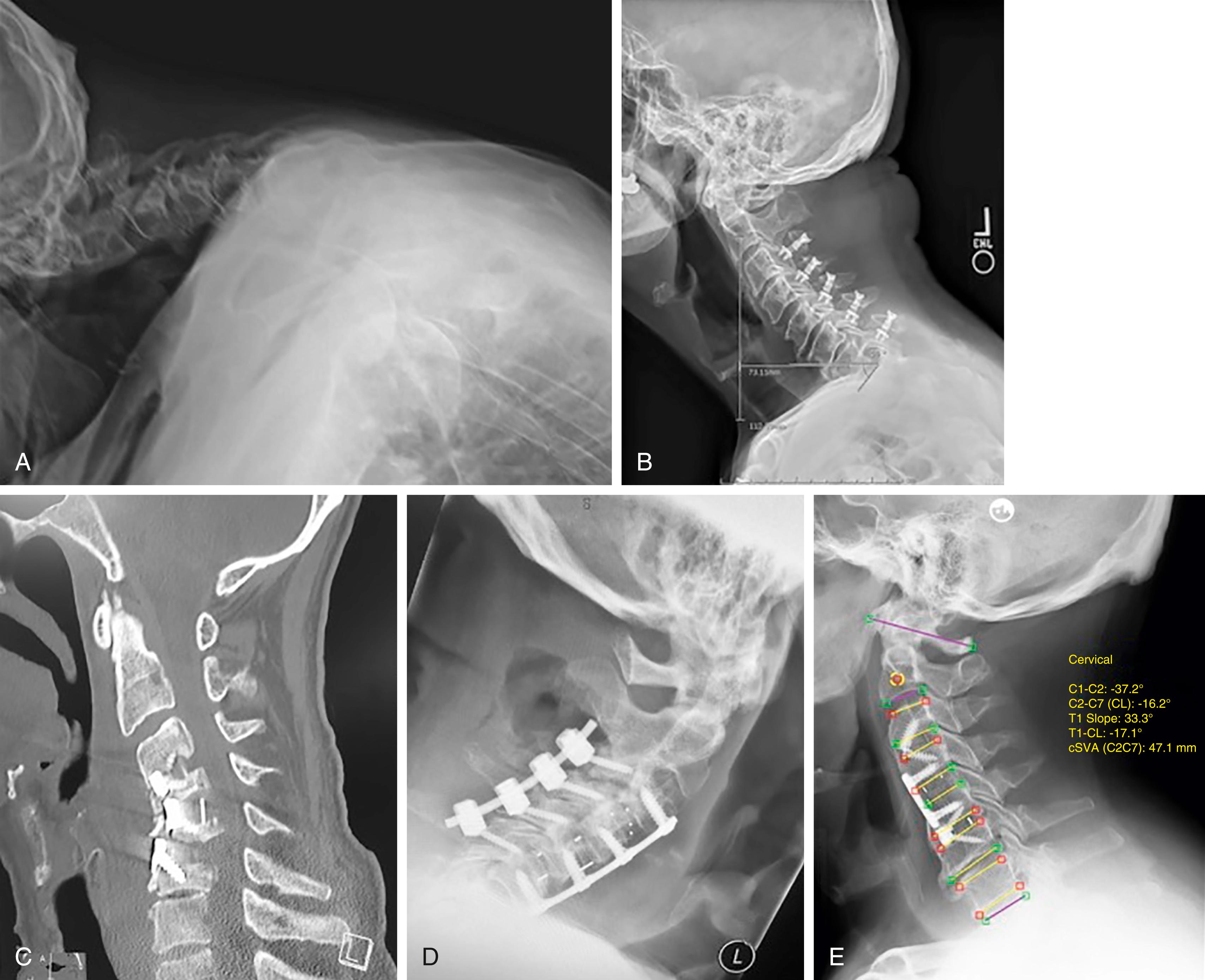 Postoperative Spinal Deformity Clinical Tree 5237