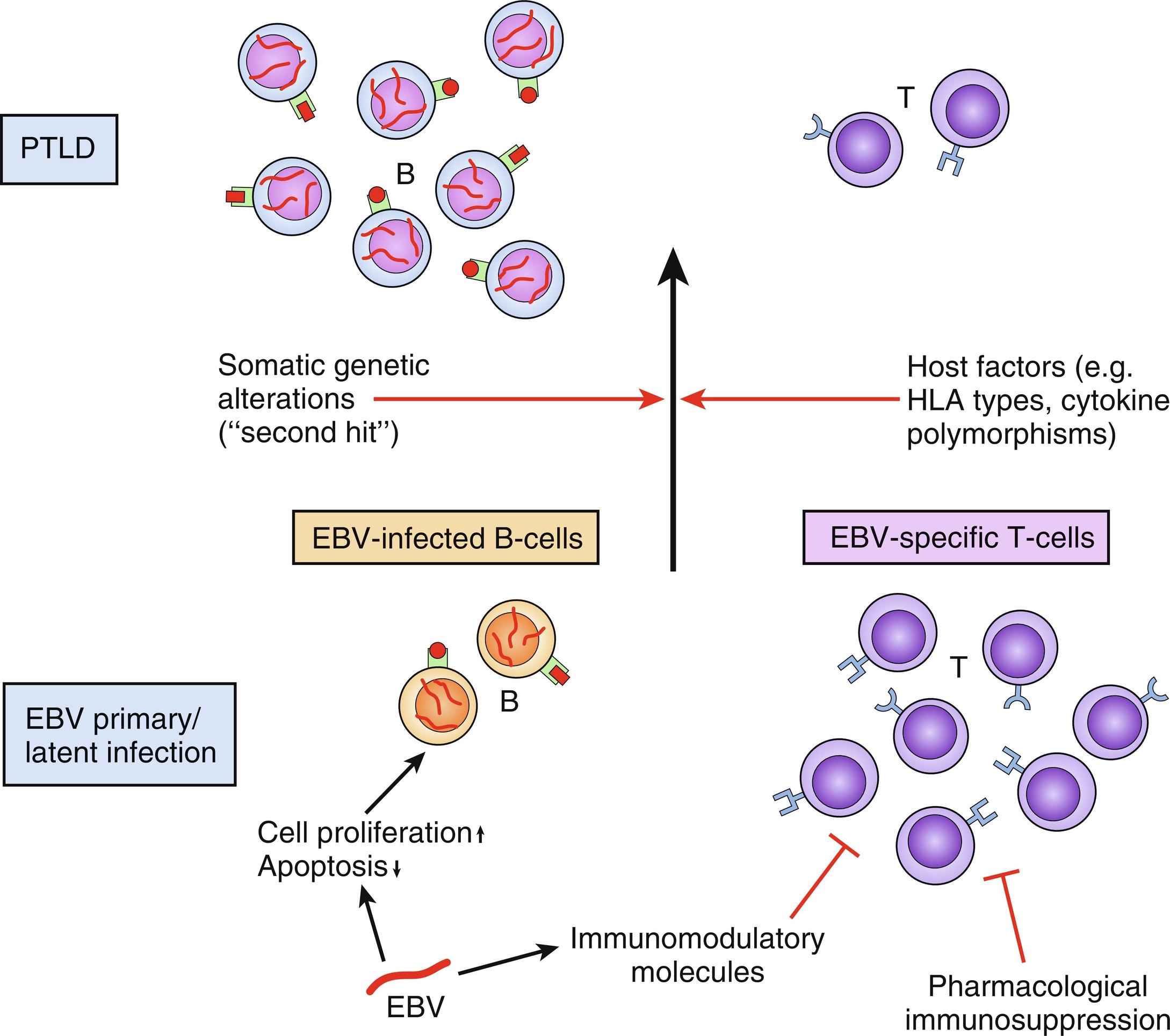 Fig. 28.1, Pathogenesis of post-transplant lymphoproliferative disease ( PTLD ) development. Shown are pathogenetic factors contributing to Epstein-Barr virus-driven PTLD development in the context of immunosuppression. EBV , Epstein-Barr virus; HLA , human leukocyte antigen.