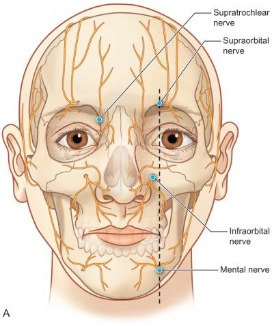 Fig. 3.15.2, Nerve blocks are essential in making the diagnosis of the nerve that is the source of posttraumatic facial pain. (A) Technique for blocking V 1 , V 2 , and V 3 through the skin. (B) Technique for blocking the anterior superior branch of V 2 which separates from the infraorbital nerve at or near the infraorbital foramen. (C) Technique for intraoral block of the inferior alveolar branch of V 3 .