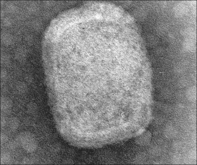 Figure 13-19, Electron microscopy of an orthopox virus (vaccinia virus).