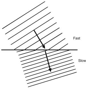 F igure 1-2, Sound refraction. When sound travels obliquely through an interface between substances that transmit sound at different speeds, the wavelength changes as shown in the illustration (top). The result is a redirection or bending of the sound, called refraction.