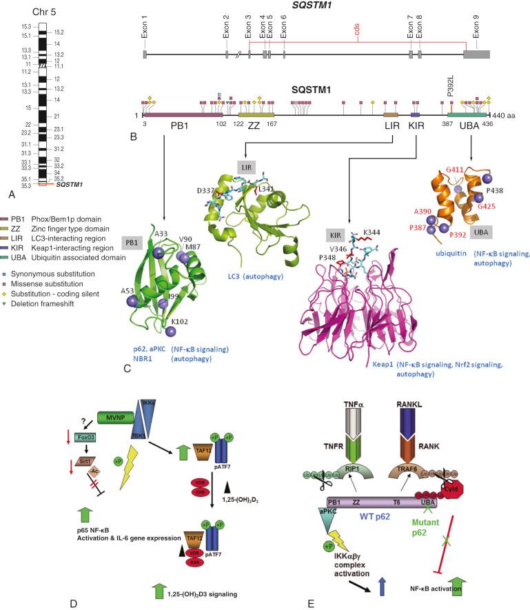 FIGURE 24-1, Molecular mechanisms of Paget's disease.