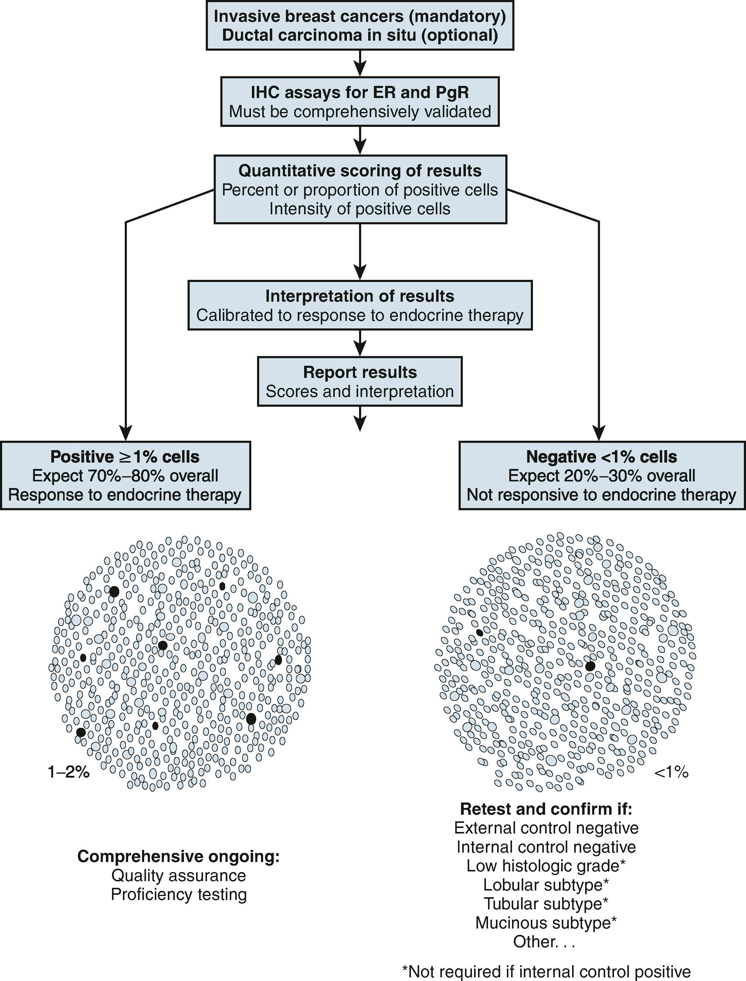 Fig. 9.1, Overview of guideline recommendations for immunohistochemical testing of estrogen and progesterone receptors in breast cancer by the American Society of Clinical Oncology and College of American Pathologists.