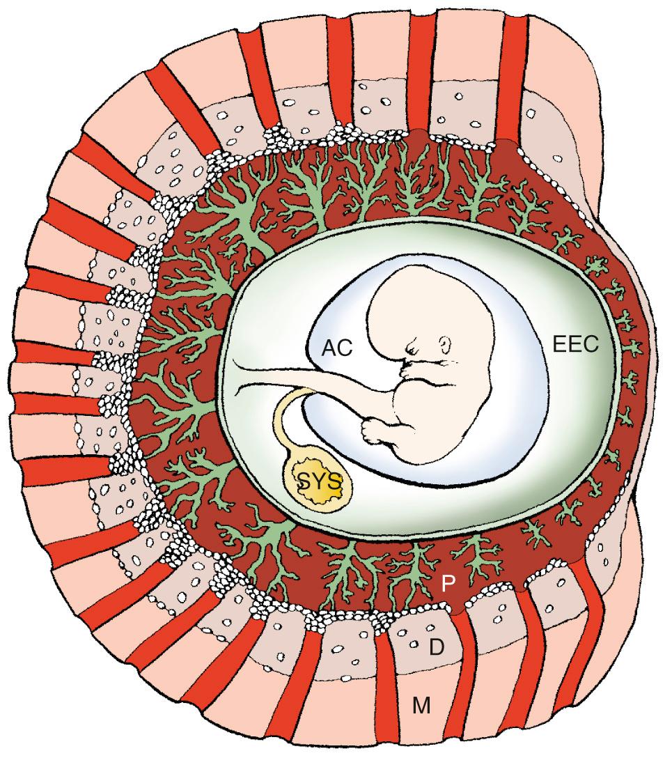 Fig. 33.1, A gestational sac at the end of the second month (8 to 9 weeks) showing the myometrium (M) , the decidua (D) , the placenta (P) , the exocoelomic cavity (ECC) , the amniotic cavity (AC) , and the secondary yolk sac (SYS) .