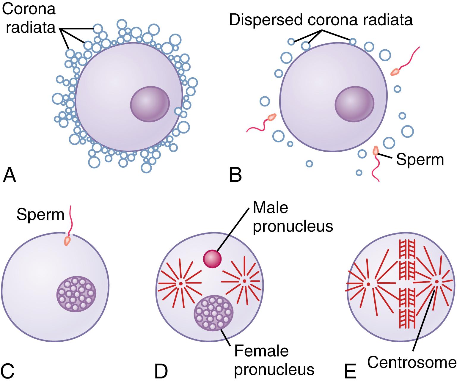 Figure 83-1., Fertilization of the ovum. A, The mature ovum surrounded by the corona radiata. B, Dispersal of the corona radiata. C, Entry of the sperm. D, Formation of the male and female pronuclei. E, Reorganization of a full complement of chromosomes and beginning division of the ovum.