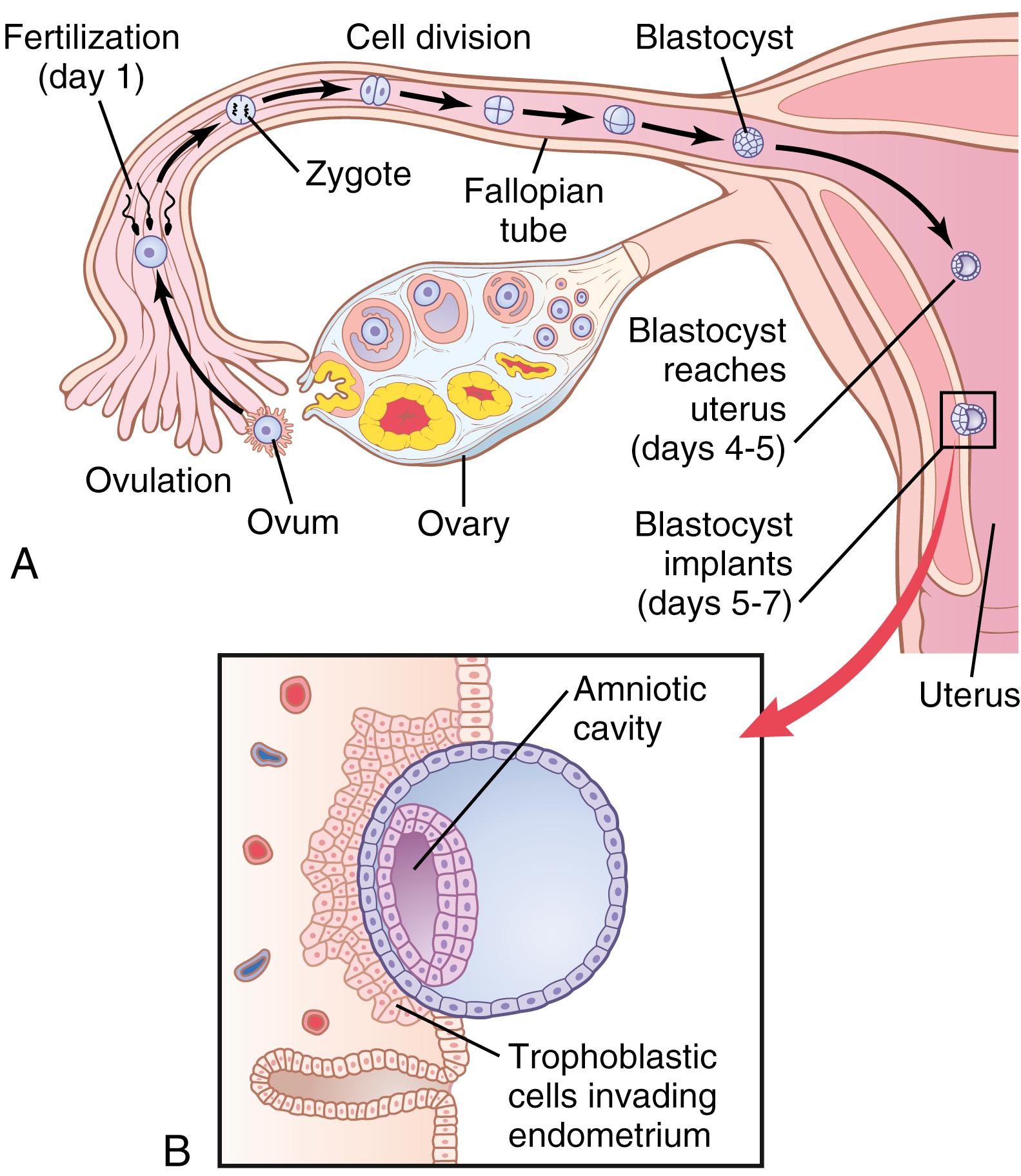 Figure 83-2., A, Ovulation, fertilization of the ovum in the fallopian tube, and implantation of the blastocyst in the uterus. B, The action of trophoblast cells in implantation of the blastocyst in the uterine endometrium.