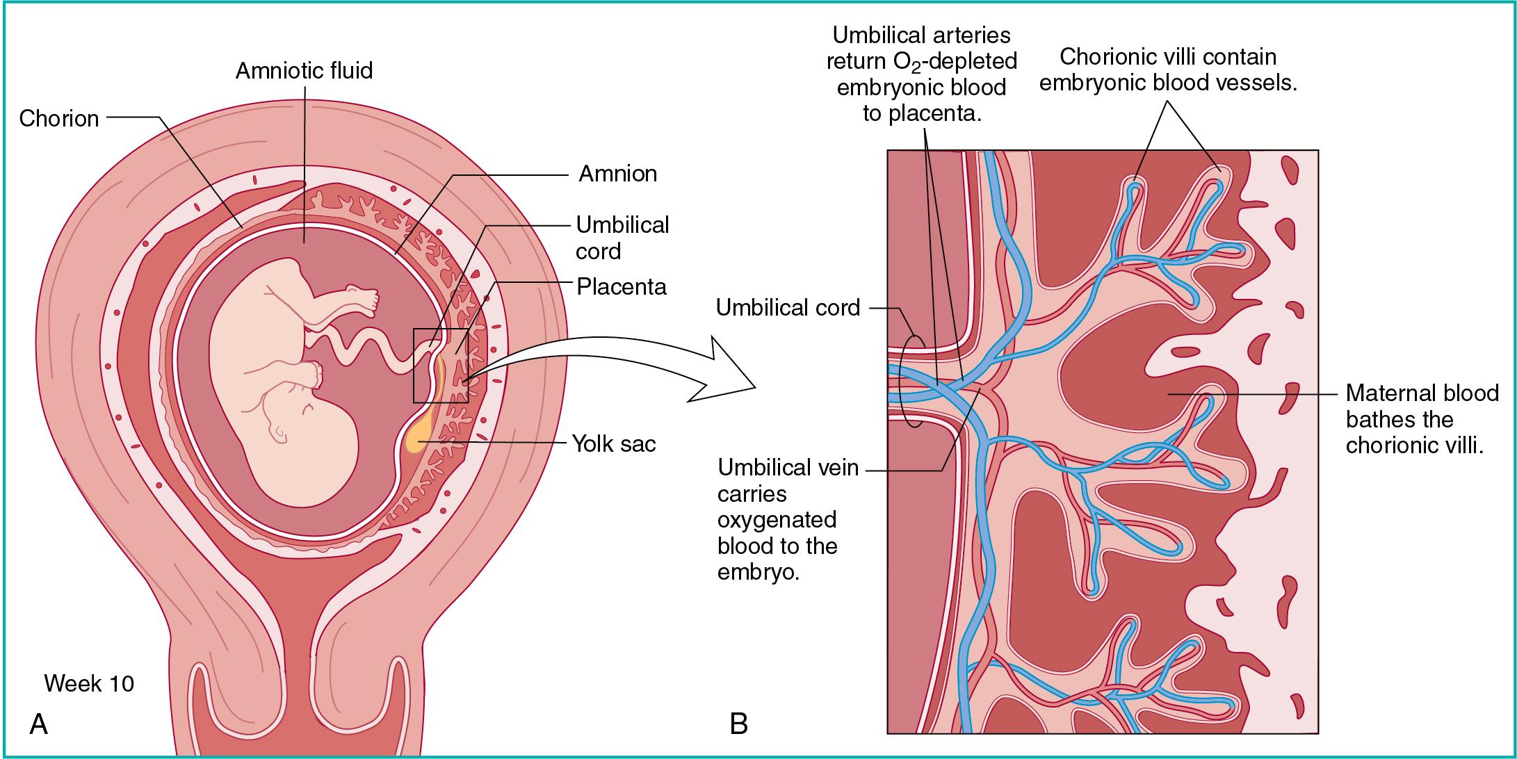 Fig. 35.1, The placenta, chorionic villi, and intervillous space. A, The position of the fetus and placenta within the uterus. B, A closer view of the villi and intervillous space.