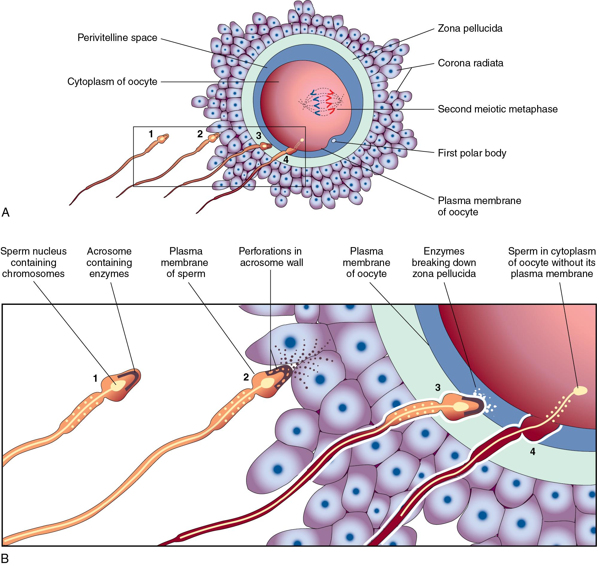 Fig. 35.3, Fertilization. A) After capacitation, the acrosome of the sperm can release its digestive enzymes. B) The enzymes digest part of the zona pellucida around the oocyte and ultimately merge the cytoplasm of the two gametes. The oocyte, arrested in metaphase II of meiosis, now resumes meiosis and generates a second polar body.