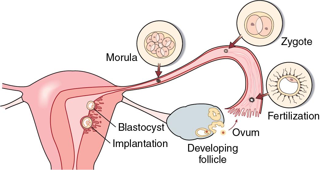 Fig. 35.4, Implantation.