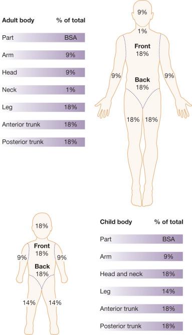 Fig. 7.1, Estimation of burn size using the rule-of-nines.