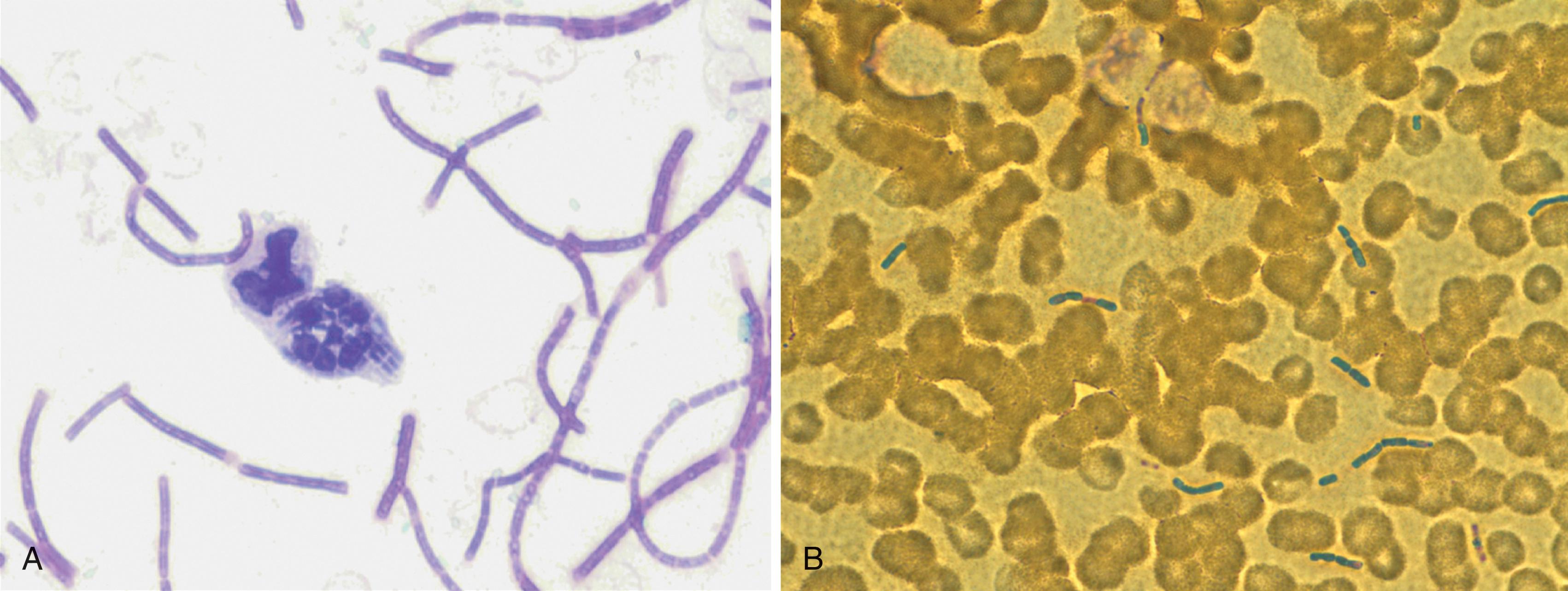 FIGURE 2, (A) Gram stain of a blood smear from an infected guinea pig demonstrating intracellular bacilli chains within a polymorphonuclear leukocyte. (B) Gram stain of peripheral blood smear from a nonhuman primate infected with Bacillus anthracis , Ames strain.