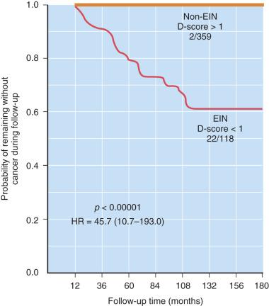 Fig. 17.1, Prospective cancer risk of an endometrial intraepithelial neoplasia (EIN) diagnosis. Long-term cancer-free survival of 477 endometrial hyperplasias was stratified by morphometry into high-risk EIN (d score < 1) and low-risk benign (d score > 1) subgroups. A total of 27% of women with EIN will have a concurrent adenocarcinoma diagnosed within 1 year of EIN diagnosis; 28 of these were excluded as cases of concurrent carcinoma. The resulting plot shows long-term cancer occurrences evolving from an EIN lesion, an event that is 46-fold more likely in EIN-bearing compared with non–EIN-bearing women.