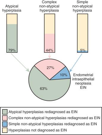 Fig. 17.2, 1994 World Health Organization (WHO) hyperplasias (four-class) rediagnosed by two-class endometrial intraepithelial neoplasia (EIN) criteria (same as WHO 2014). These version criteria differ, so the correlation is not fixed. The colored portions of the bar graphs show the approximate percentages of each 1994 WHO hyperplasia class that will be diagnosed as EIN. The remaining 1994 WHO hyperplasias not diagnostic of EIN ( yellow ) will be allocated to unopposed estrogen (anovulatory), polyp, and other benign categories. The pie chart shows the relative contributions of each hyperplasia type to the EIN diagnostic category in a biopsy series of sequential endometrial hyperplasias seen in a busy hospital practice.