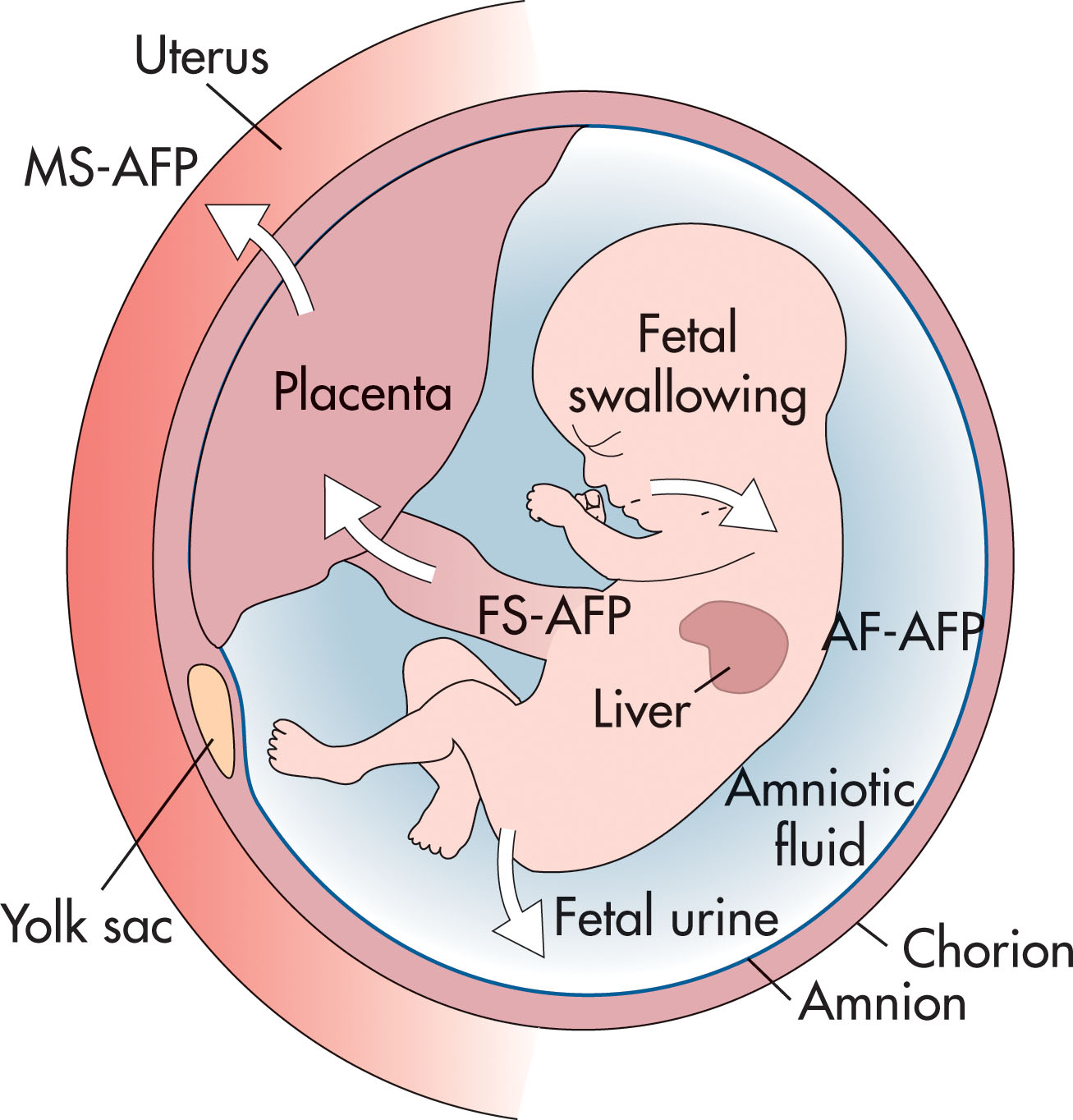 Fig. 55.1, Production and distribution of alpha-fetoprotein (AFP) into its three components: fetal tissues, amniotic fluid (AF), and maternal serum (MS). FS , Fetal serum.