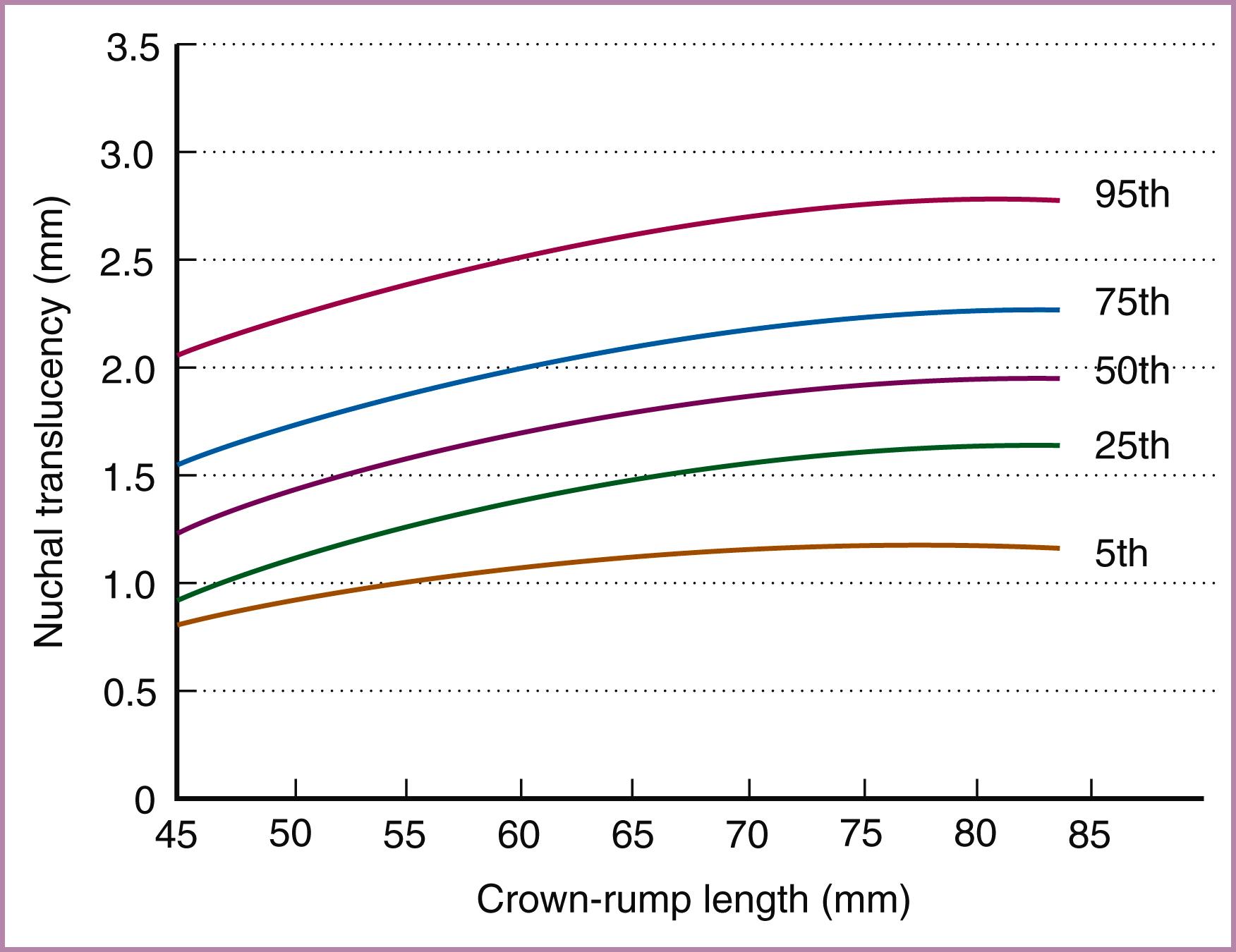 Figure 30.2, Normative curves for nuchal translucency measurement between 11 and 14 weeks’ gestation.