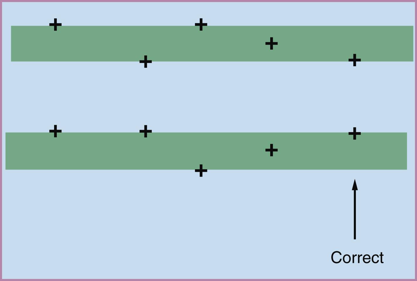 Figure 30.4, Proper placement of calipers for measuring nuchal translucency.