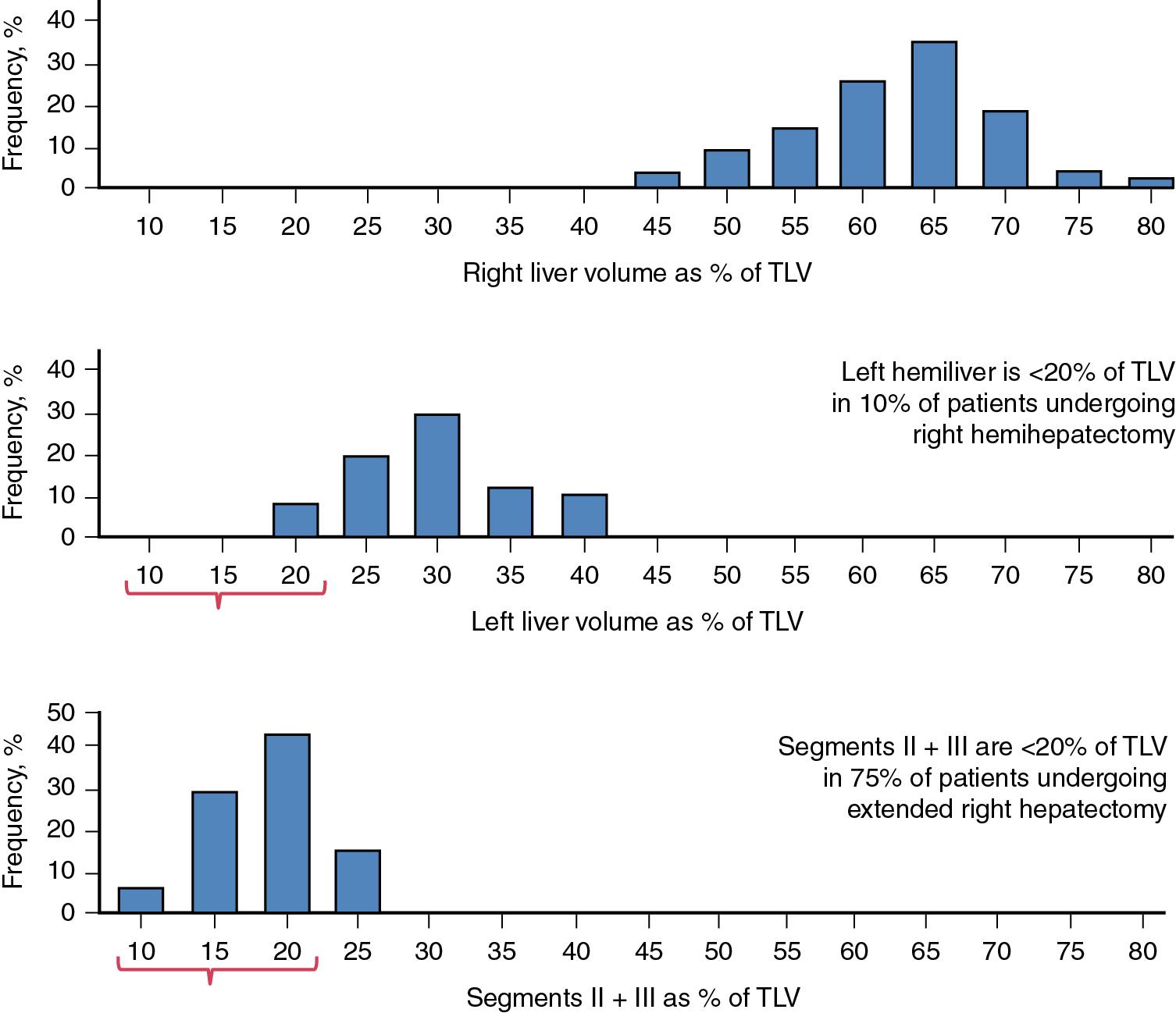 FIGURE 102C.2, Distribution of patients by future liver remnant volume according to type of major hepatectomy.