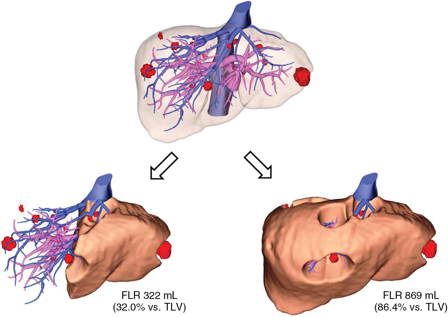 FIGURE 102C.3, Surgical planning using a three-dimensional simulation software.