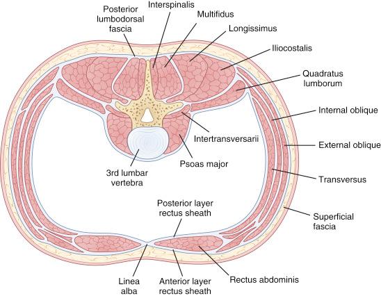 Fig. 12.2, Coronal section of lumbar musculature.