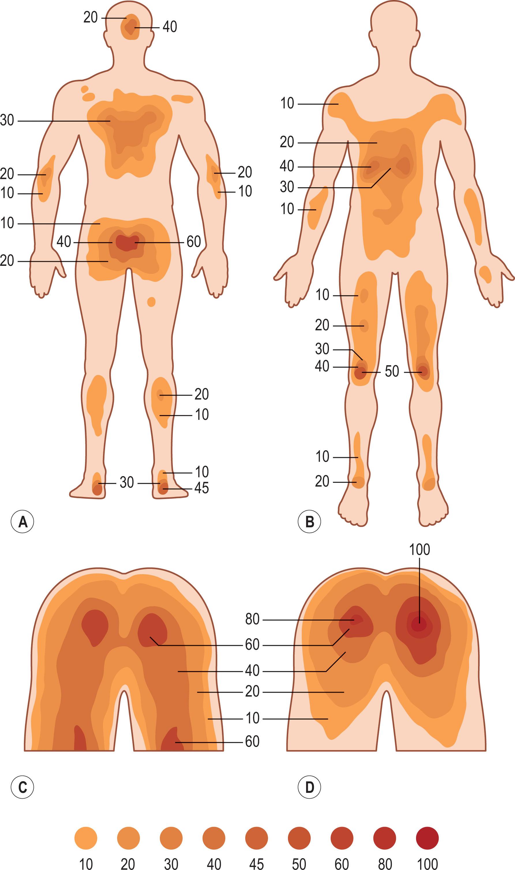 Figure 16.2, Distribution of pressure in a healthy adult male while (A) supine, (B) prone, (C) sitting with feet hanging freely, and (D) sitting with feet supported. Values expressed in mmHg.
