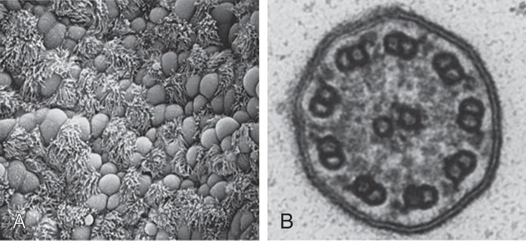 Fig. 433.1, Electron photomicrographs showing (A) an airway epithelium grown in primary culture, showing ciliated and nonciliated cells and (B) a normal motor cilium.