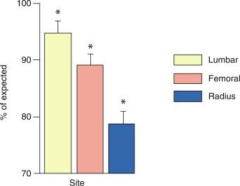 Fig. 53.2, Bone densitometry in primary hyperparathyroidism. Data are shown in comparison to age- and sex-matched normal subjects. Divergence from expected values is different at each site ( p = 0.0001).