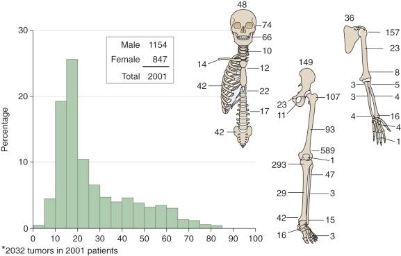 Fig. 50.1, Age, sex, and skeletal distribution of osteosarcoma in 2001 patients.