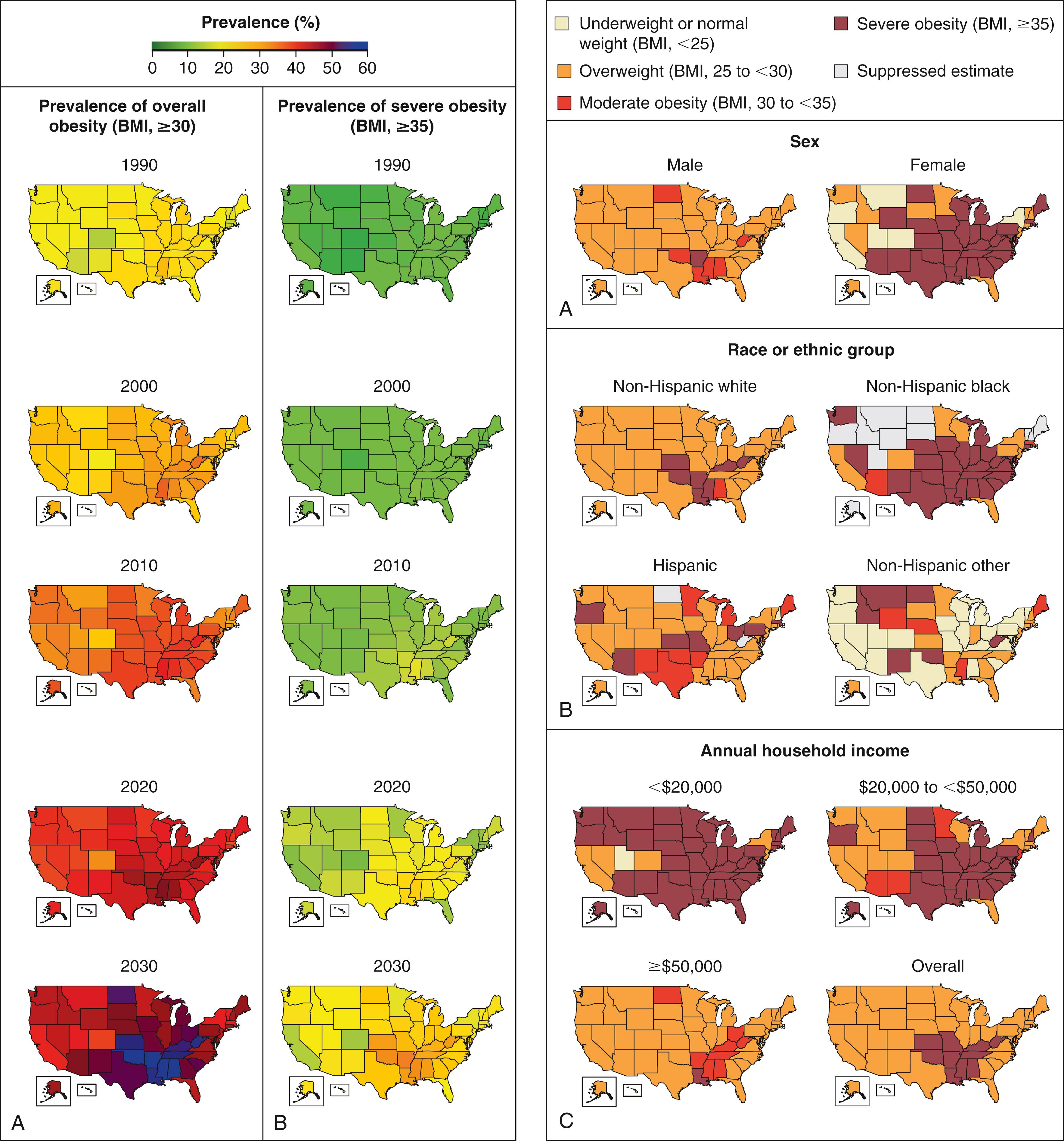FIGURE 25.4, Estimated prevalence of obesity (body-mass index [BMI] >30 kg/m 2 ) in the United States, from 1990 to 2030 (left) and the most common projected BMI category in 2030 (underweight or normal weight, overweight, moderate obesity, or severe obesity), according to sex, race/ethnicity, and annual income (right) .