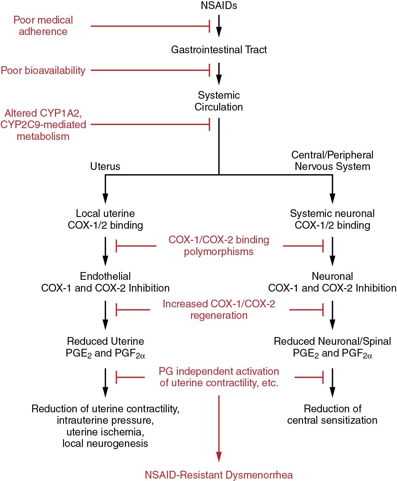 Fig. 35.4, Nonsteroidal antiinflammatory drug–resistant dysmenorrhea.