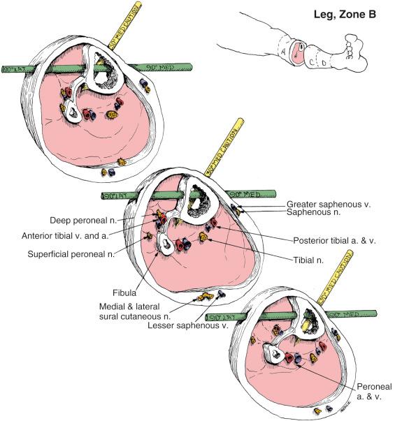 Fig. 8.14, Leg, Zone B. Anatomic Considerations
