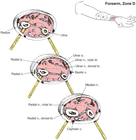Fig. 8.25, Forearm, Zone D. Anatomic Considerations.
